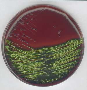 EMB agar for the detection and isolation of pathogenic Enterobacteriaceae-500g