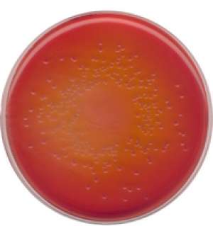 MacCONKEY agar for the isolation of Salmonella, Shigella and coliform bacteria (According harm. EP/USP/JP)