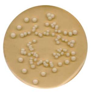 Potato dextrose agar for microbiology