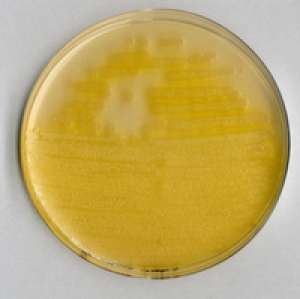 Pseudomonas agar F (base) for microbiology Merck