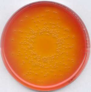 Deoxycholate lactose agar for microbiology Merck