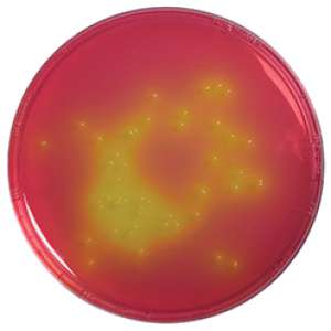 Mannitol salt phenol-red agar for microbiology (According harm. EP/USP/JP) Merck