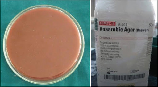 Anaerobic Agar (Brewer) 500g Himedia