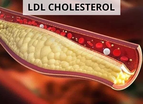 Axit linoleic giúp giảm lượng cholesterol LDL trong máu và cải thiện huyết áp một cách đáng kể